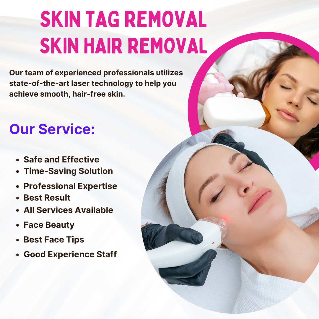 Skin Tag Removal